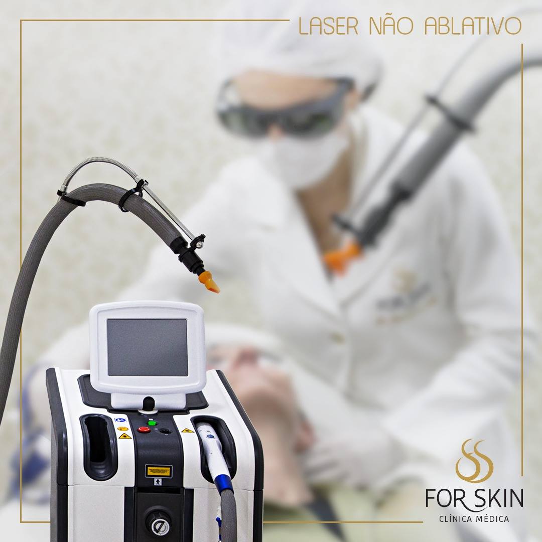 Laser fracionado não ablativo trata estrias e cicatrizes