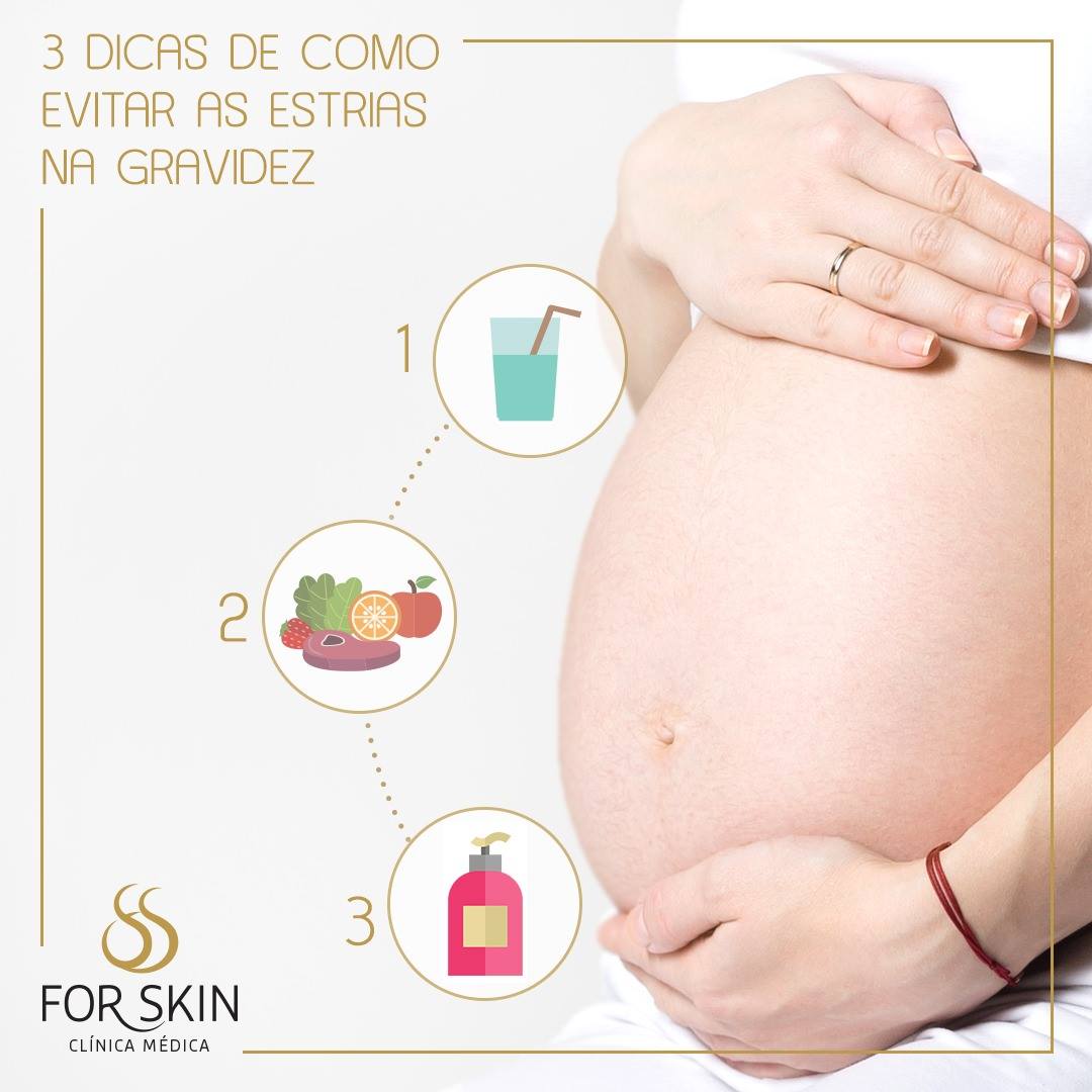 3 dicas de como evitar estrias na gravidez