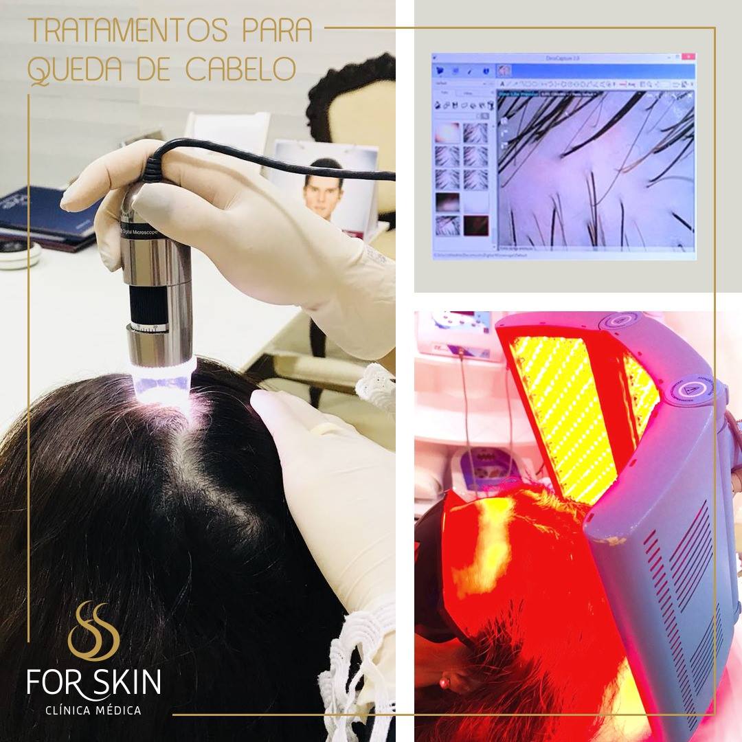 Descubra os principais fatores para a queda de cabelo!